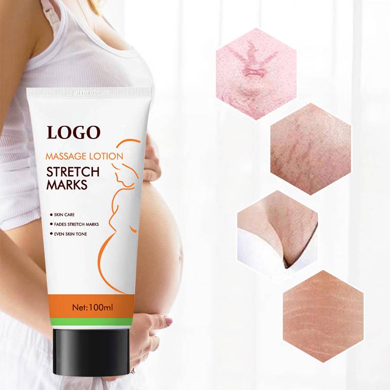 Oem Odm Custom Repair Firming Stretch Mark Cream Private Label Stretch Marks Removal Cream